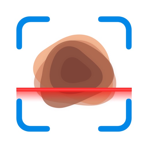 Mole Checker & Scanner: DermAi For